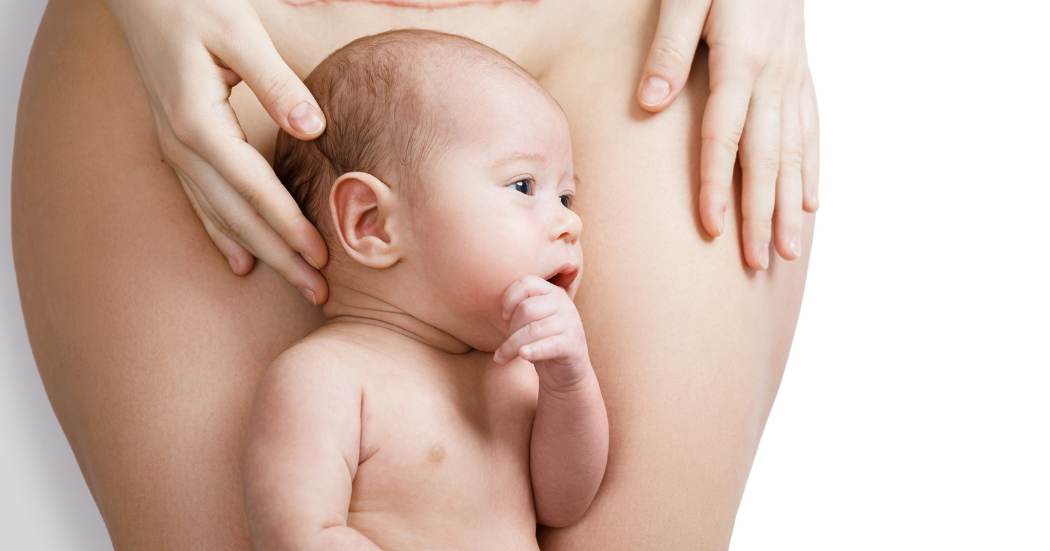 Scar Healing: Perineal and Cesarean
